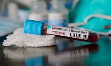 उत्तराखंड: एक और विधायक हुए कोरोना संक्रमित