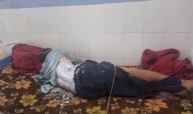 थराली :विद्युत विभाग की लापरवाही से करेंट की चपेट में आया संविदाकर्मी 