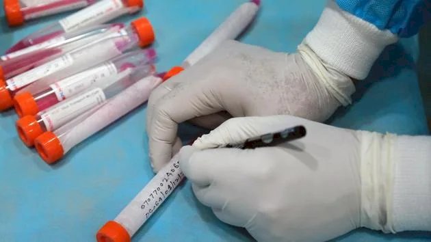 बाहरी राज्यों से देहरादून आने के लिए 72 घंटे पहले की आरटीपीसीआर निगेटिव रिपोर्ट अनिवार्य
