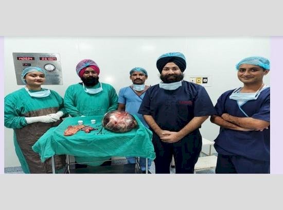 आयुष्मान योजना के तहत 61 वर्षीय महिला के पेट से विशाल डिम्बग्रंथि ट्यूमर को सर्जरी द्वारा हटाया गया